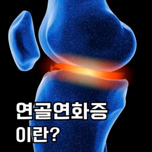 연골연화증 이란?