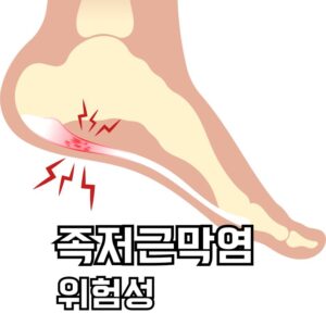 족저근막염 위험성