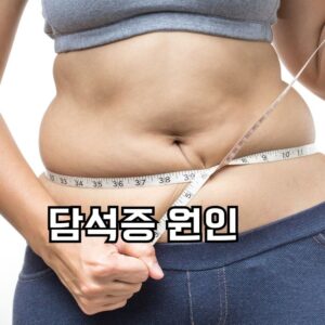 담석증 원인