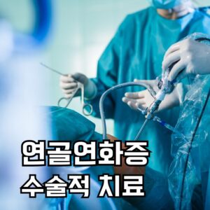 연골연화증 수술적 치료