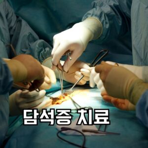 담석증 치료