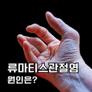 류마티스관절염 원인은?