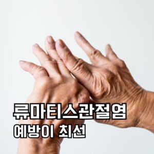 류마티스관절염 예방이 최선