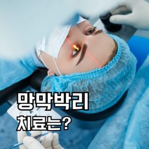 망막박리 치료방법은?
